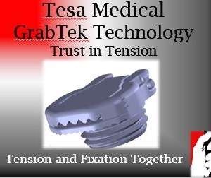 Photo of Tesa Medical Inc